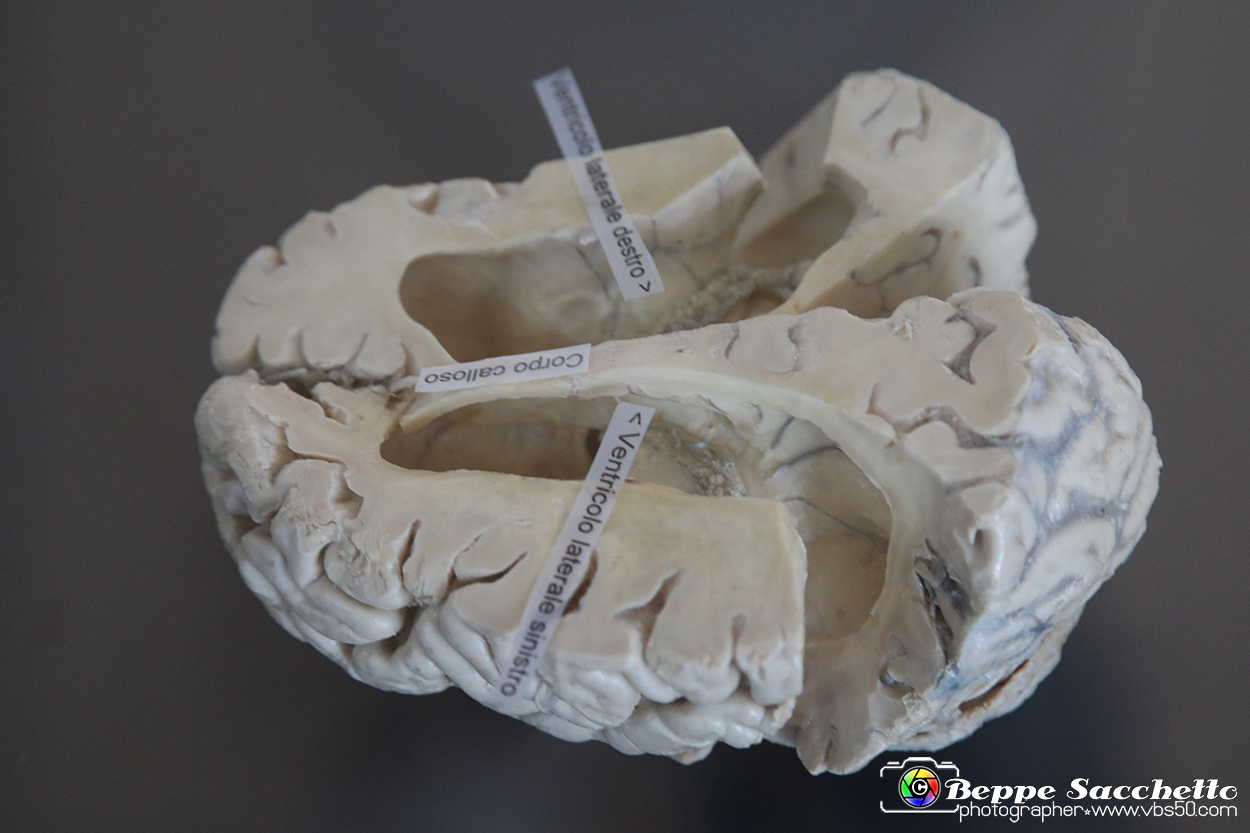 VBS_3012 - Ventricoli cerebrali - Mostra Body Worlds.jpg
